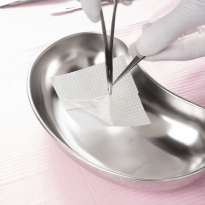 Birth Tissues Put to a High Energy Trauma Test