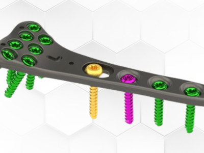 FDA Clears Bone Fixation System With Locking Wrist Plates