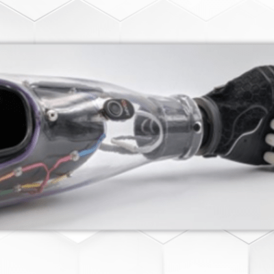 Hanger Bets BIG on Intuitive Prosthetics 
