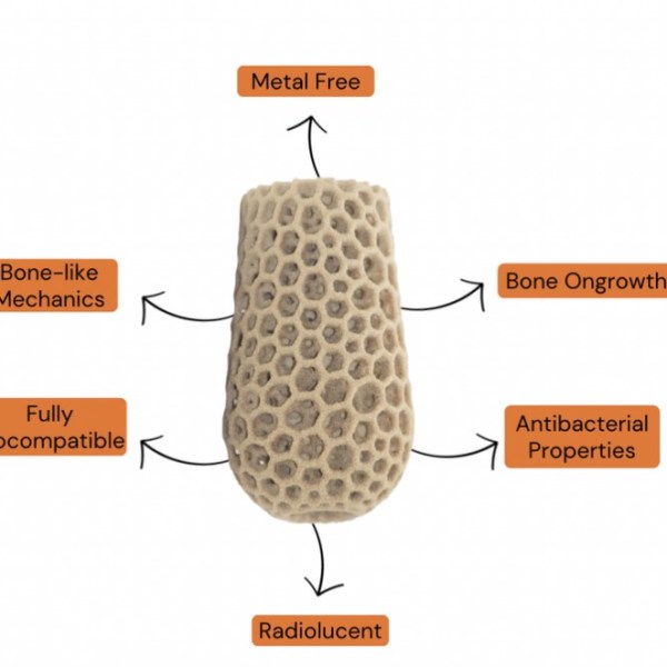 Metal vs PEKK – PEKK Wins, It’s Not Close